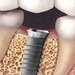 Dental Crown Health - clinica stomatologica